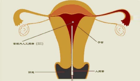 女宝