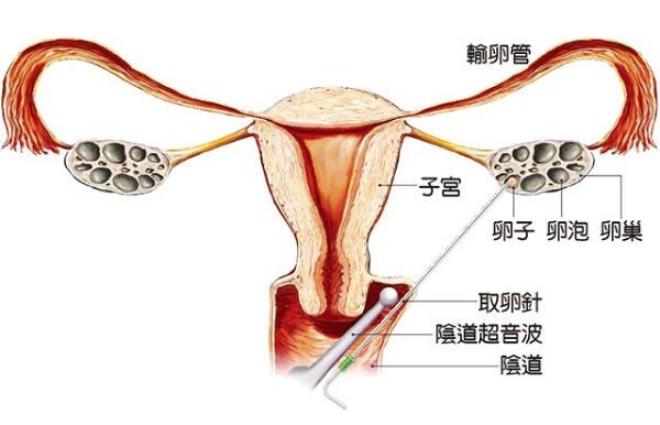 初生婴儿